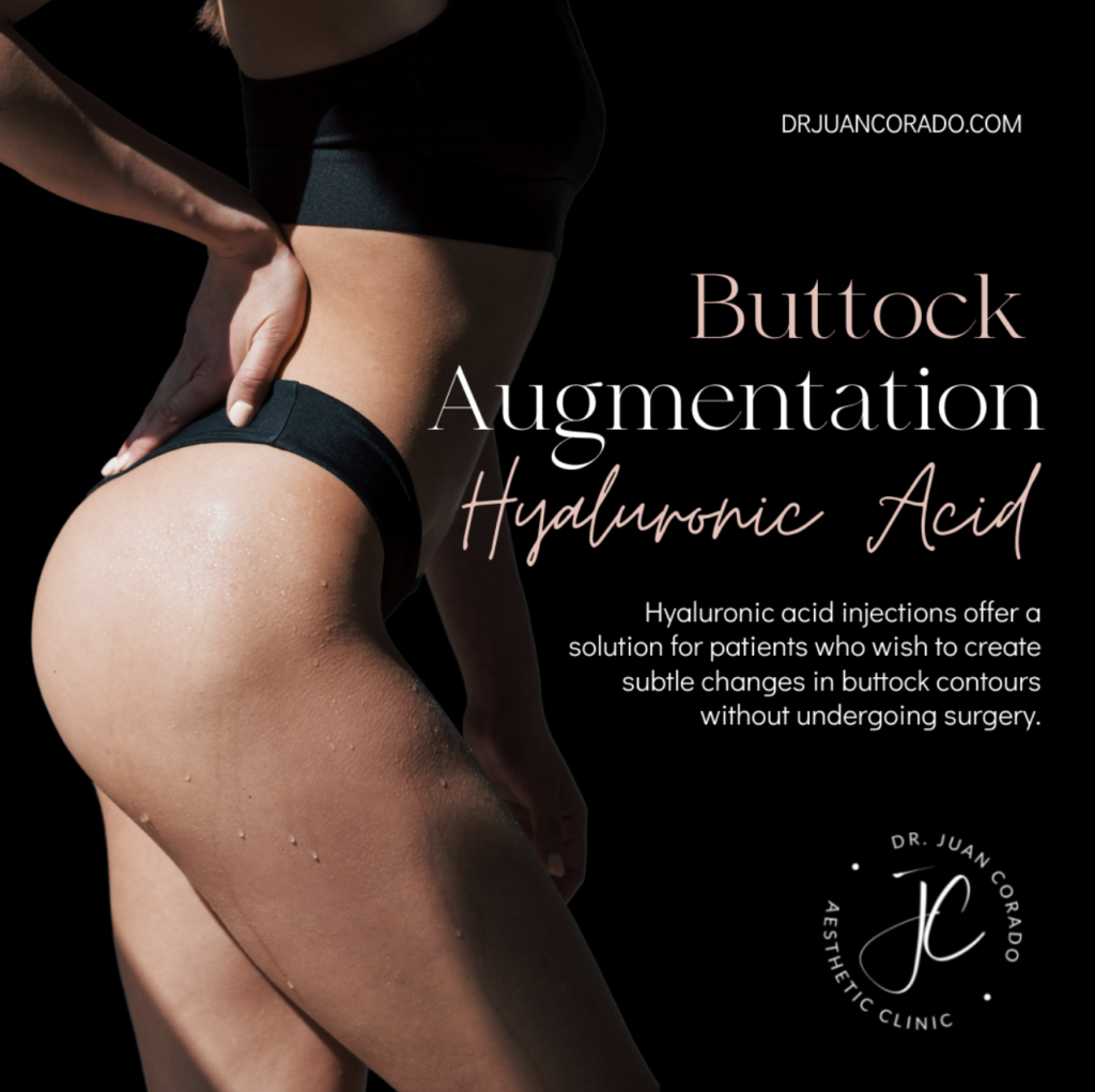 buttock augmentation hyalucronic acid